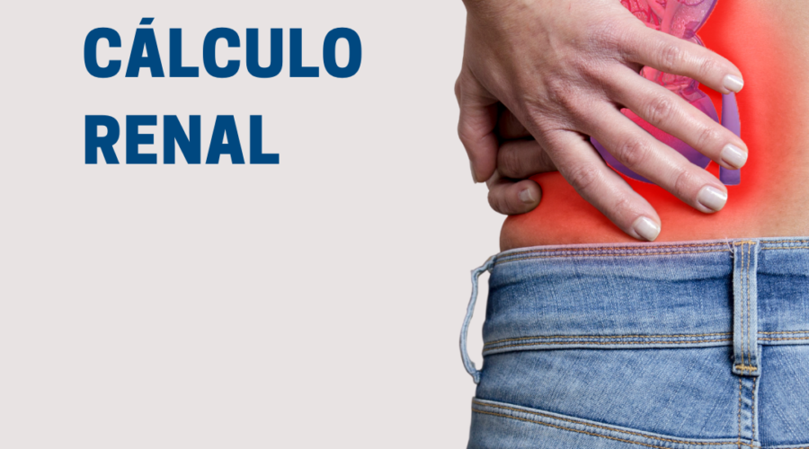 Cálculo renal